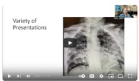 Respiratory and Flu Season: Counselling Kids and Balancing Workload video screenshot- chest xray